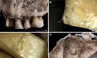 Fire likely killed a group of Stone Age humans uncovered in Ukraine