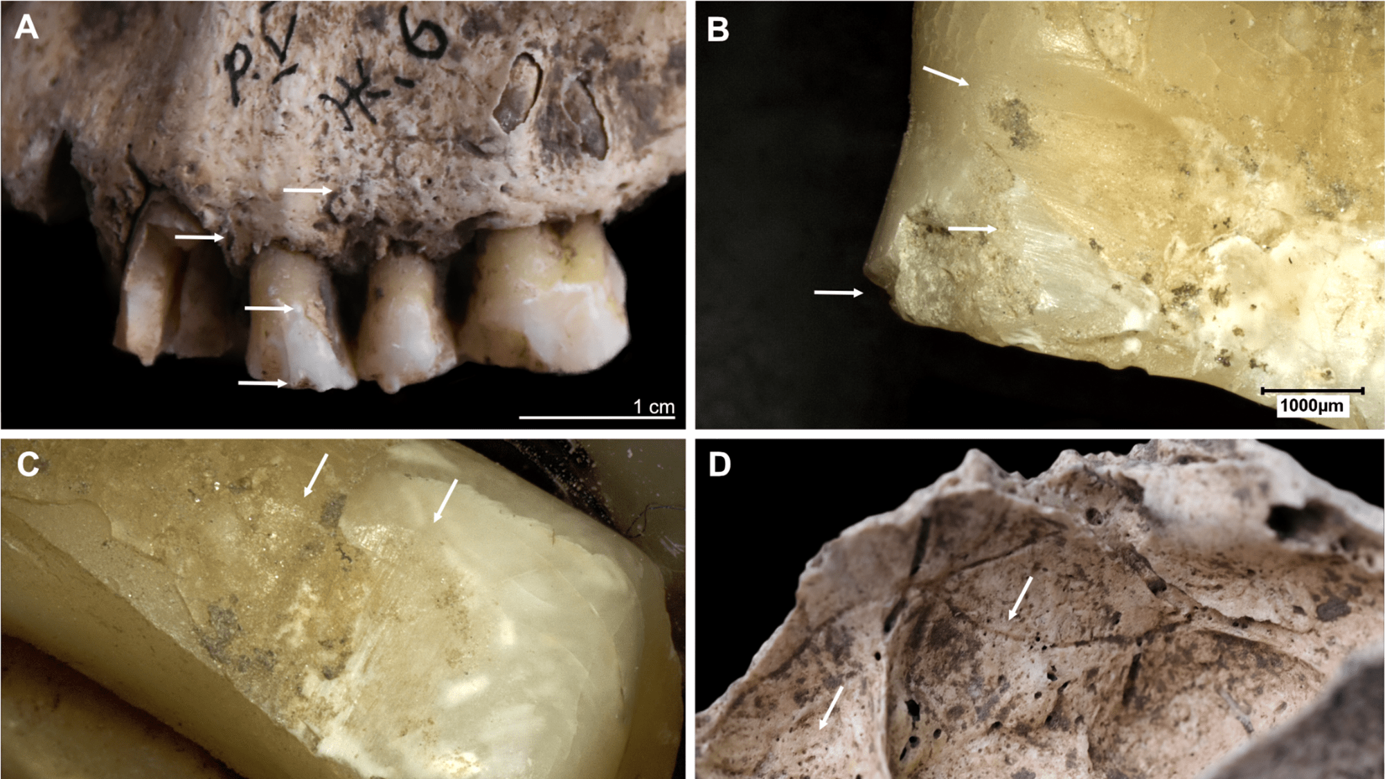 Fire likely killed a group of Stone Age humans uncovered in Ukraine