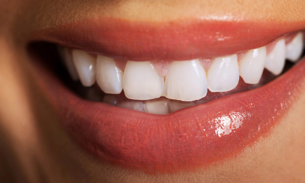 Close up on woman white teeth.