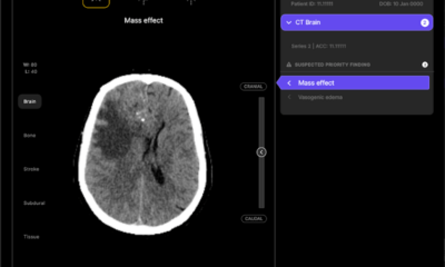 Australian health tech startup Harrison.ai scores $112M Series C