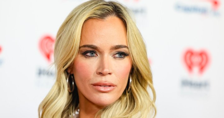 Teddi Mellencamp reveals she has ‘multiple’ brain tumours, will undergo surgery - National