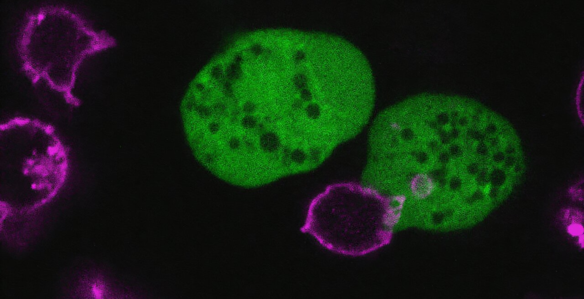 This parasite rips apart human cells and wears them as disguises
